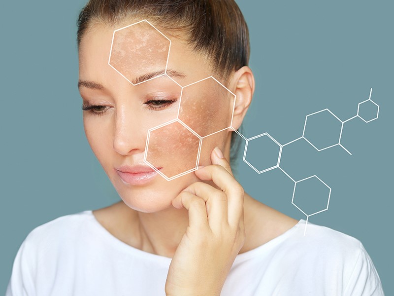 Types-of-acne-skiinaceclinic
